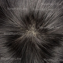 Load image into Gallery viewer, Lace Center With Poly Back Stock Hair System New-Hair-Line